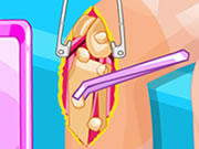 Play Barbie Knee Surgery
