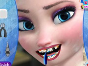 Play Elsa Dentist Appointment