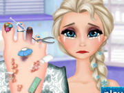 Play Elsa Foot Doctor