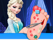 Play Elsa Foot Surgery