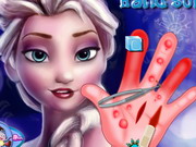 Play Elsa Hand Surgery