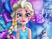 Play Injured Elsa Frozen