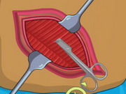 Play Operate Now: Appendix Surgery