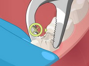 Play Operate Now: Dental Surgery