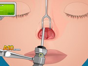 Play Operate Now: Nose Surgery
